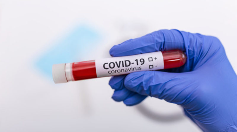 Testagem da Covid-19